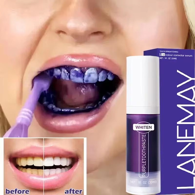 V34 Purple Teeth Whitening Too - Purple Toning Shampoo review and price